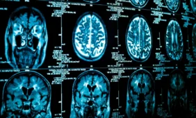 Vegetacinės būklės pacientų mintis atskleidžia smegenų skenavimo rezultatai