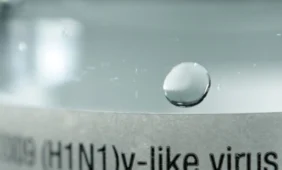 Turės tirti kiaulių gripu sirgusiojo mirties aplinkybes