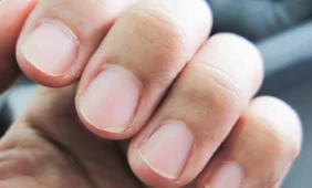 Prieš vėžį kovojama ir varlėmis