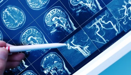 Epileptiku apsimetinėjęs amerikietis sės į kalėjimą