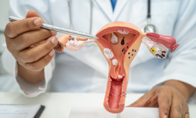 Gimdos miomos išsivysto lytinio gyvenimo vengiančioms moterims