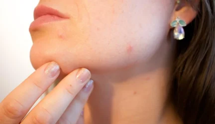 Ką apie žmogaus charakterį sako apgamai ant veido?