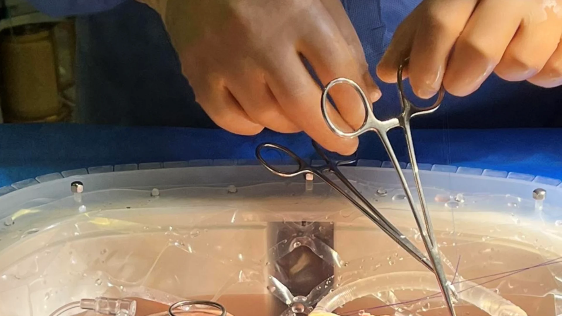Sukurtas pirmas implantuojamas dirbtinio inksto prototipas