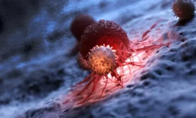 Vis daugiau lietuvių serga onkologinėmis ligomis