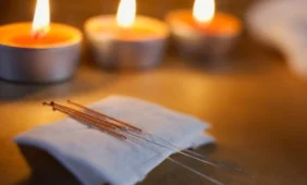 Akupunktūra kartais efektyvesnė už vaistus