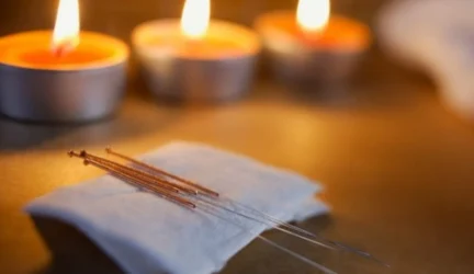 Akupunktūra kartais efektyvesnė už vaistus