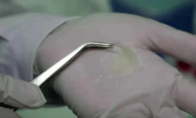 Mokslininkai sukūrė dirbtinę odą