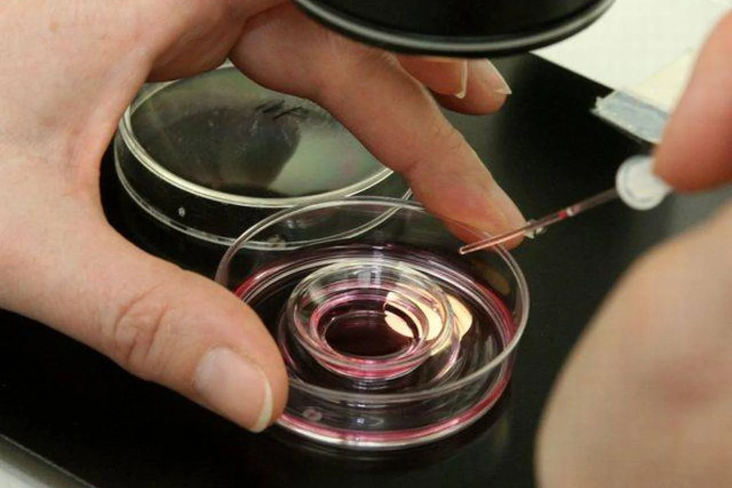 Sperma iš mėgintuvėlio tapo realybe