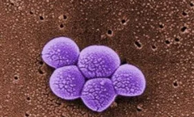 Varis įveikė antibiotikams atsparų auksinį stafilokoką