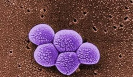 Varis įveikė antibiotikams atsparų auksinį stafilokoką