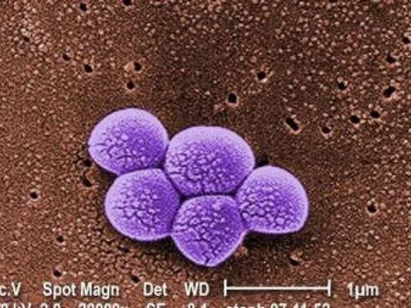 Varis įveikė antibiotikams atsparų auksinį stafilokoką