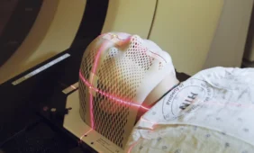 Radaro įrenginys galvos traumą diagnozuoja skenuodamas žmogaus eiseną