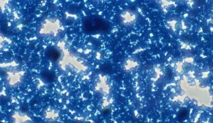A. Laiškonis: E coli infekcija – pamoka visiems