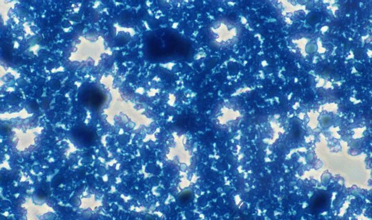 A. Laiškonis: E coli infekcija – pamoka visiems