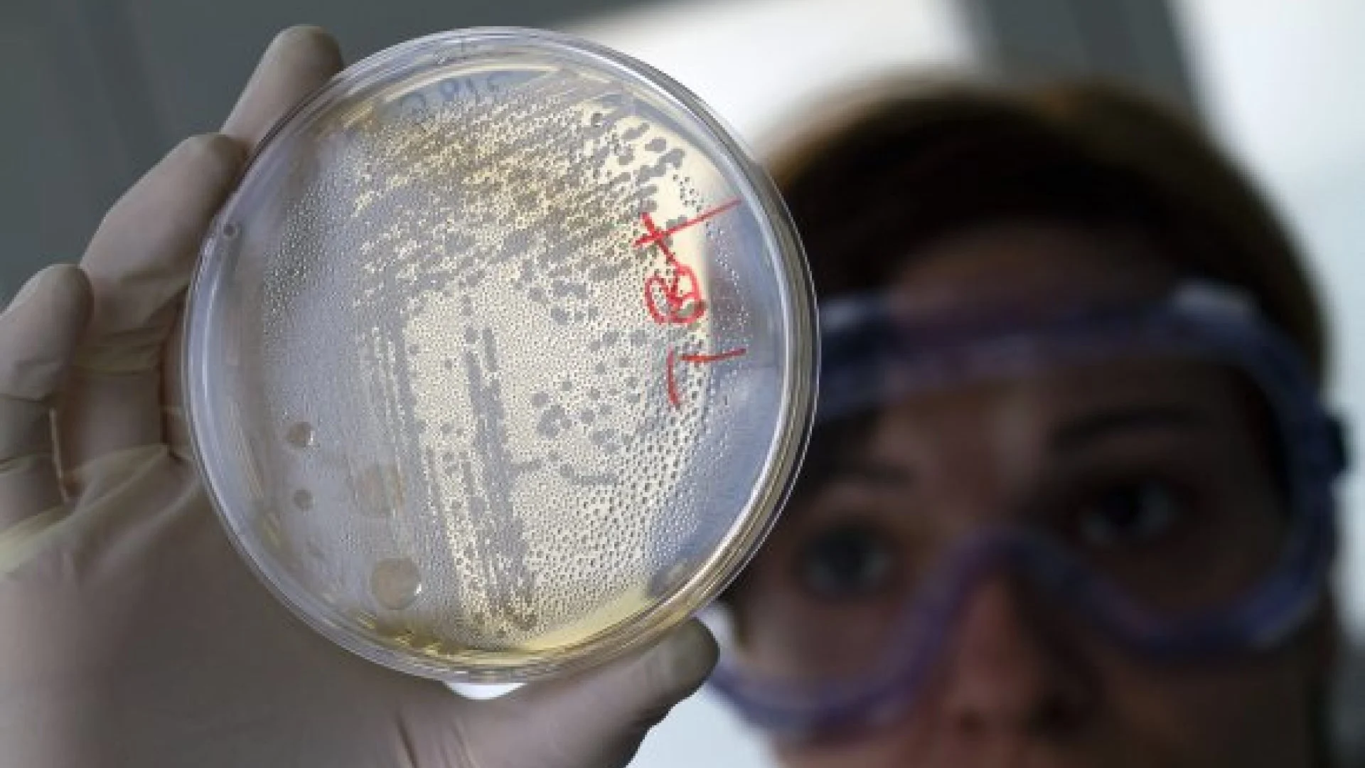E. coli bakterija nusinešė jau 36 gyvybes