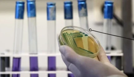 Nuo E.coli infekcijų jau mirė mažiausiai 29 žmonės