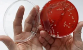 Radviliškio rajone – ūmus žarnyno infekcijos prie