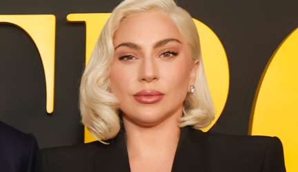 Lady Gaga naudoja vaistus nuo plikimo