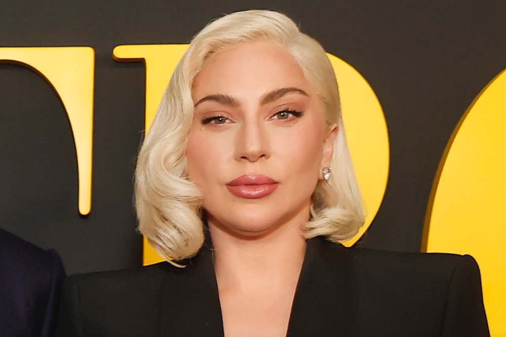 Lady Gaga naudoja vaistus nuo plikimo
