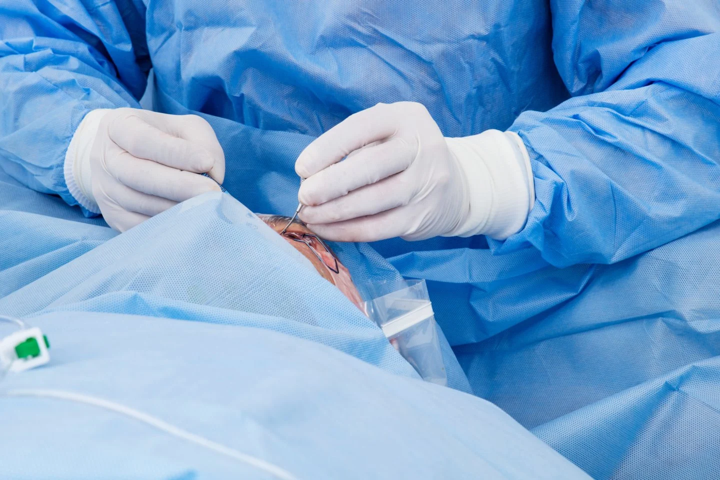 5 pacientams persodinti ŽIV užkrėsti organai