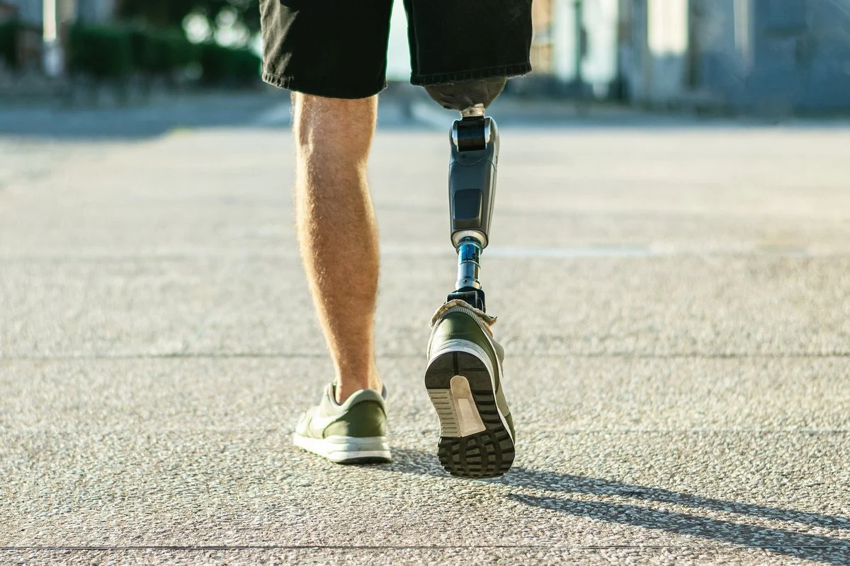 Kojos protezas padėjo apmulkinti apsaugą