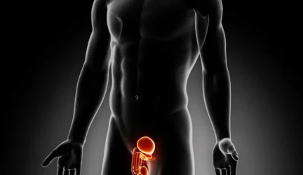 Gerybinė prostatos hiperplazija ir dieta