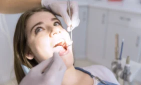 Kompozicinės plokštelės odontologija