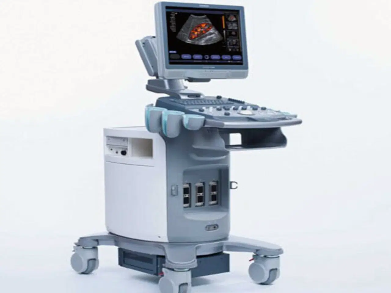 Siemens Acuson X300“