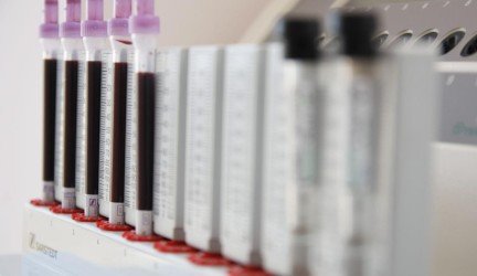 Apatiškas pavasaris: koks pavojus už to slypi?