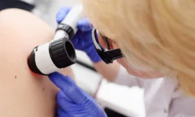 Melanoma – tyli, bet grėsminga odos liga