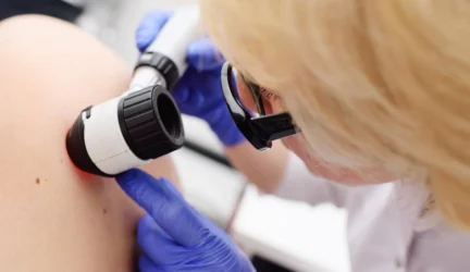 Melanoma – tyli, bet grėsminga odos liga
