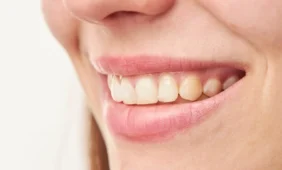 Implantacija be sinuso dugno pakėlimo