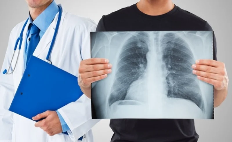Plaučių ligų diagnostikai ir gydymui Santariškių klinikų medikai pažabojo šaltį