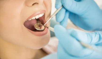 Sveika ir estetiška šypsena – didesnis pasitikėjimas savimi bei patogesnis gyvenimas