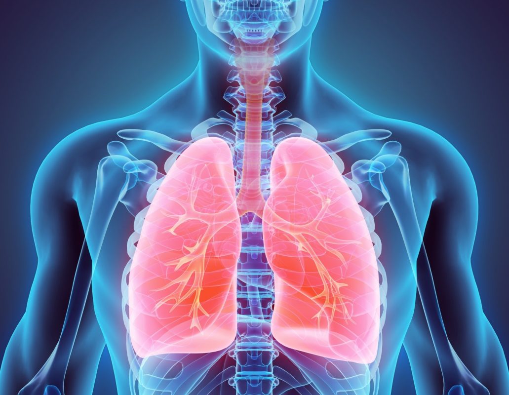 Plaučių vėžio simptomai ir stadijos