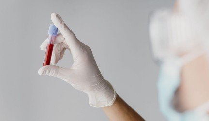 Kraujo tyrimai Klaipėdoje: kaip pasirinkti kliniką?