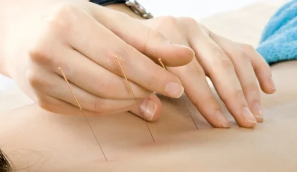 Apibrėžta alternatyvioji ir papildomoji medicina