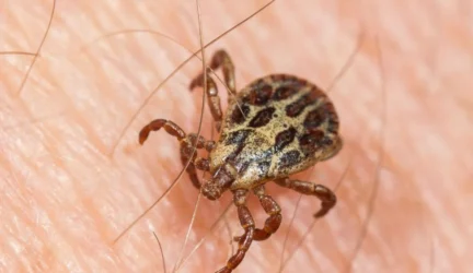 Gydytoja epidemiologė atsakė į dažniausiai pateikiamus klausimus apie Laimo ligą