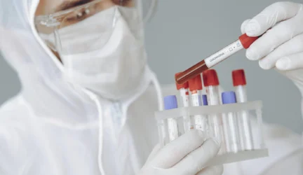 Šią savaitę profilaktiniai tyrimai visoje šalyje – tikslinėms darbuotojų grupėms