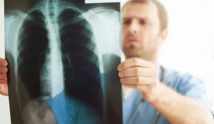 Gydytojo sudaryta atmintinė: pneumokoko ABC