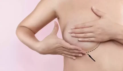 Krūtų implantų sukeliamos ligos: kaip prižiūrėti krūtų implantus ir kada juos keisti?