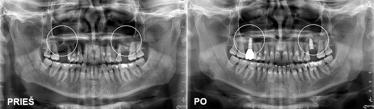 Chirurgija – gyd. Dalius Matkevičius Protezavimas – gyd. Kristina Gegeckaitė Klinika „Ortodenta“