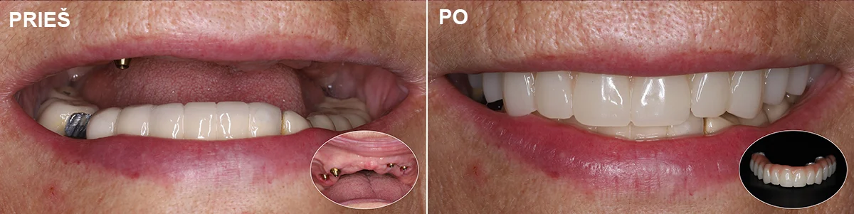 Chirurgija – gyd. Dalius Matkevičius Protezavimas – gyd. Kristina Gegeckaitė Klinika „Ortodenta“