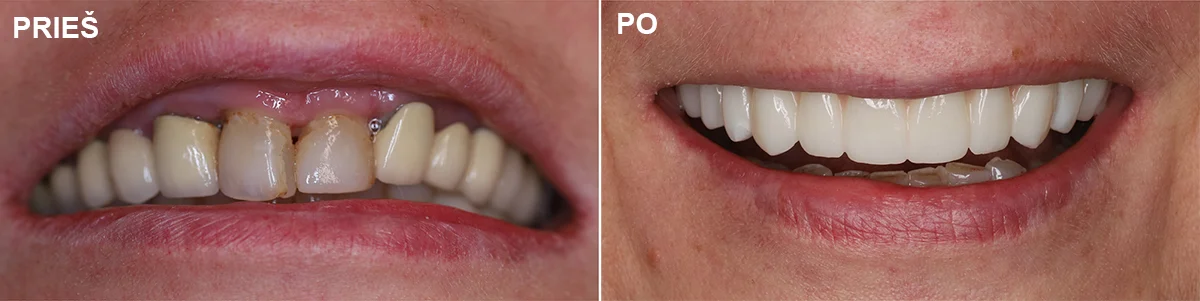 Chirurgija – gyd. Dalius Matkevičius Protezavimas – gyd. Kristina Gegeckaitė Klinika „Ortodenta“