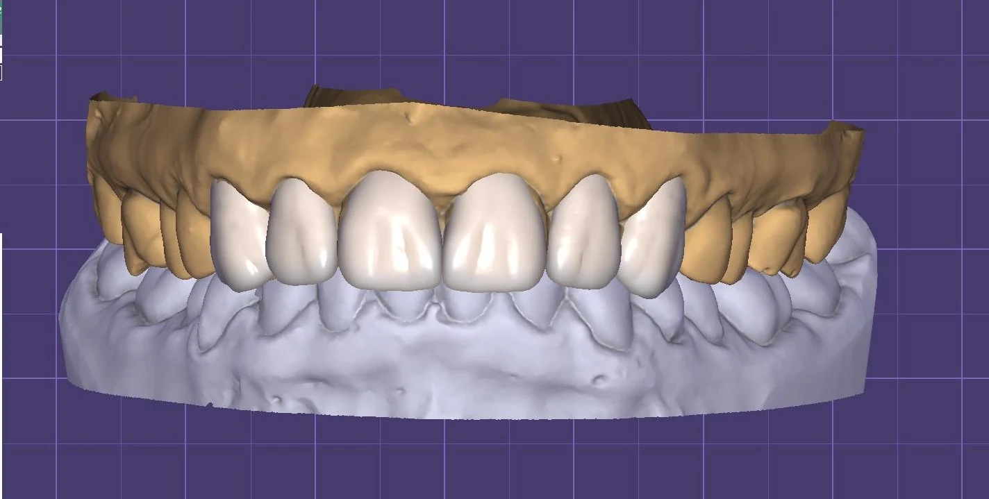 Skaitmeninis šypsenos dizainas