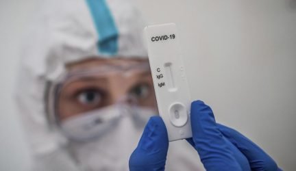 covid antikūniai