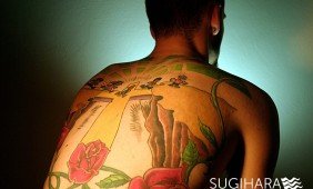 tatuiruočių, permanento, randų šalinimas