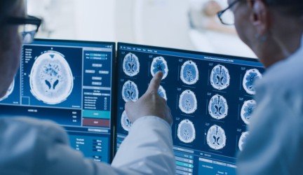 Metastazės galvos smegenyse gydomos taikant  naują radiochirurgijos metodą