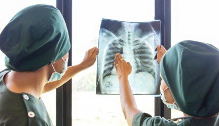 Tuberkuliozės gydymas šiandien – iššūkiai ir inovacijos