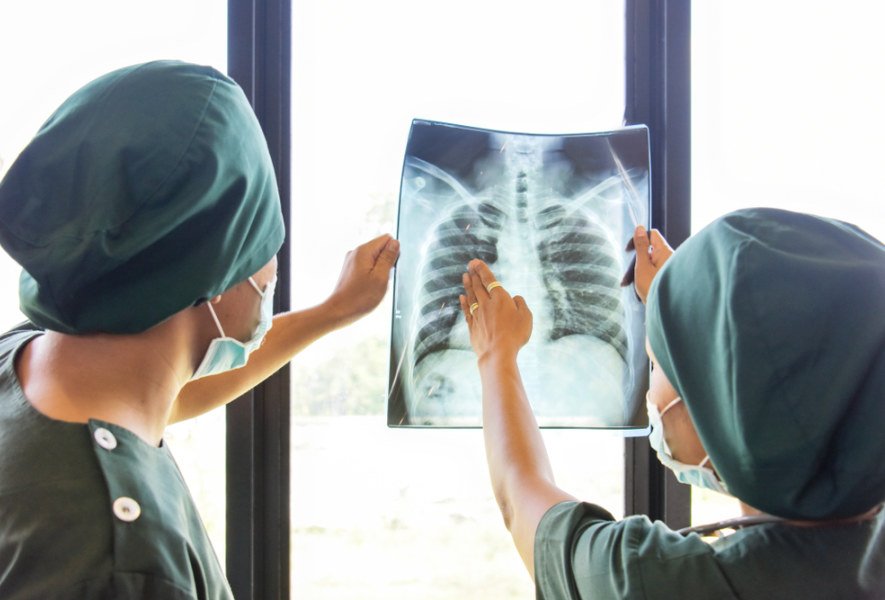 Tuberkuliozės gydymas šiandien – iššūkiai ir inovacijos